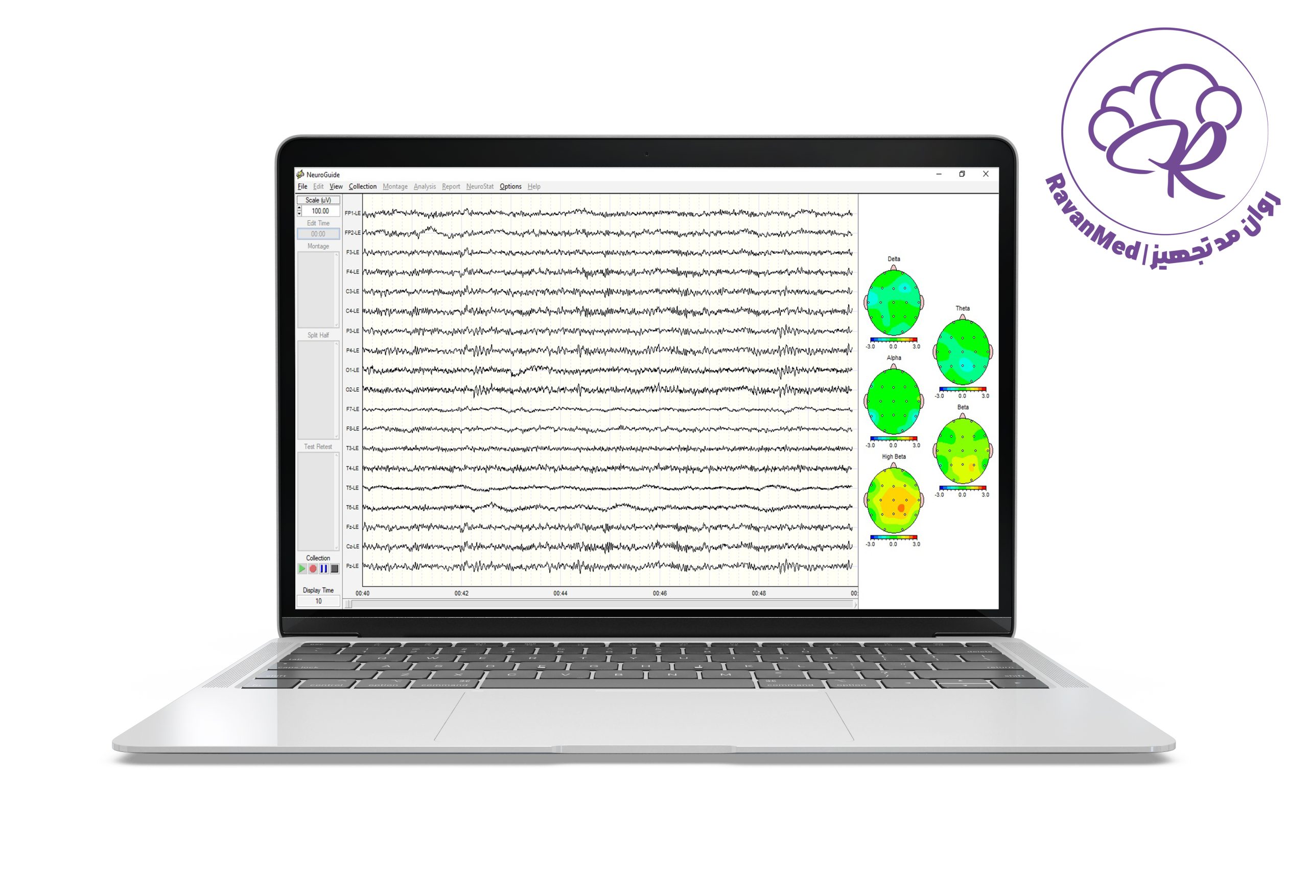 neuroguid.site خرید و قیمت نرم افزار نورگاید ( دانلود و نصب نرم افزار Neuroguide ) - روان مد تجهیز