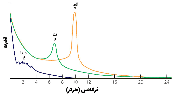 امواج نقشه مغزی برای درمان آلزایمر