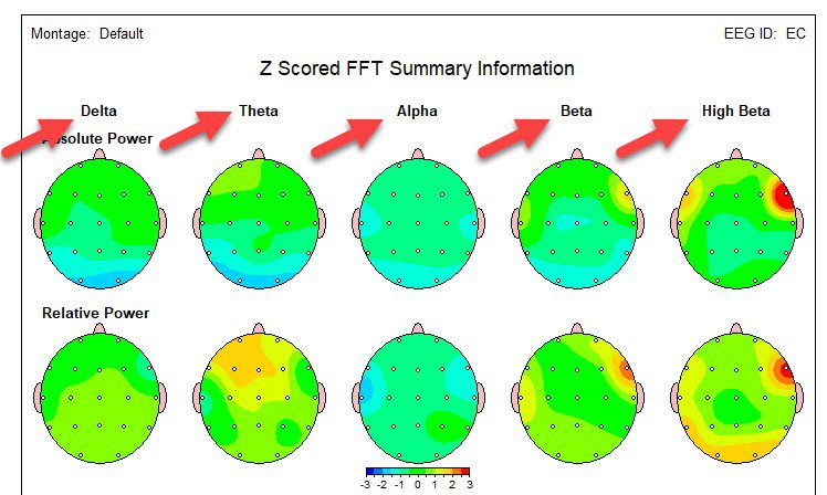 نام فرکانس های دستگاه QEEG
