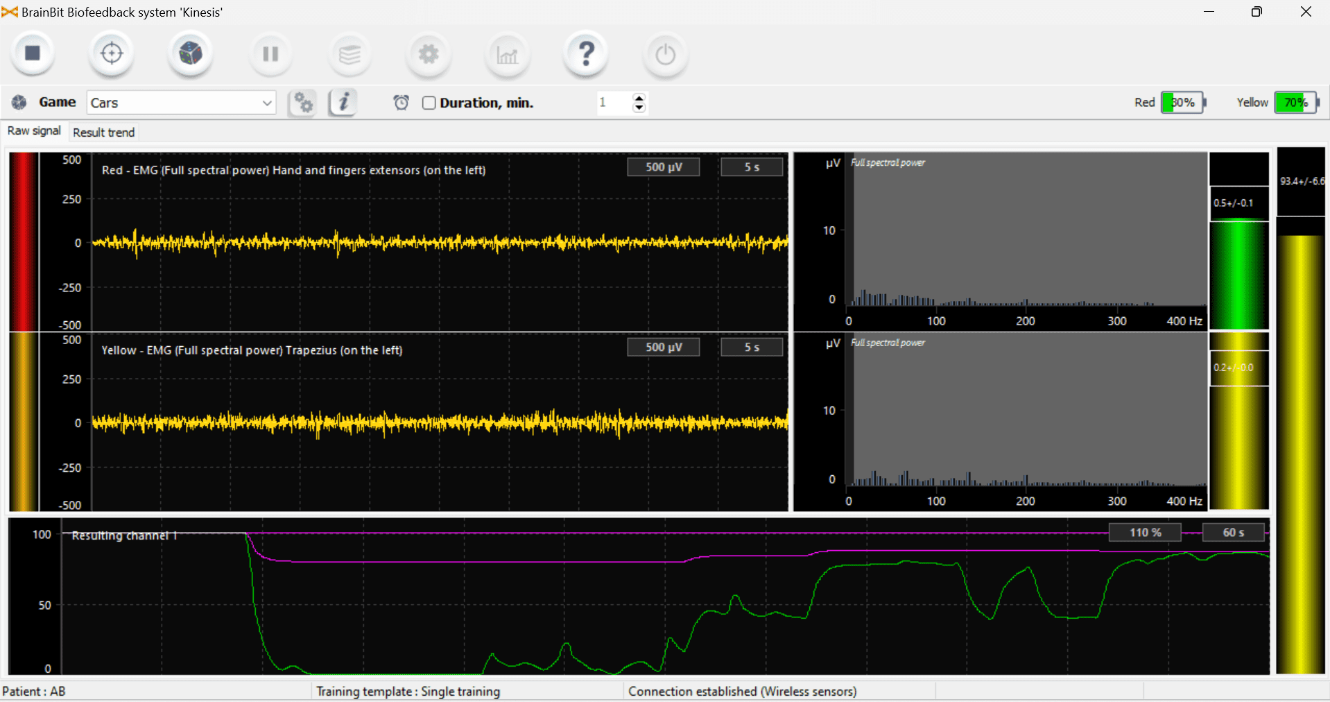 عوارض بیوفیدبک و نحوه ی درمان بیوفیدبک - روان مد تجهیز