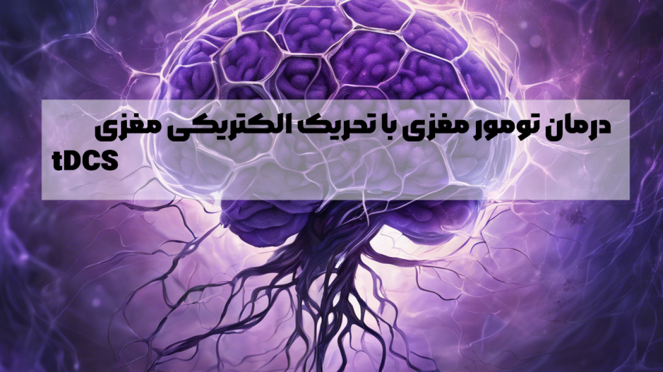 درمان تومور مغزی