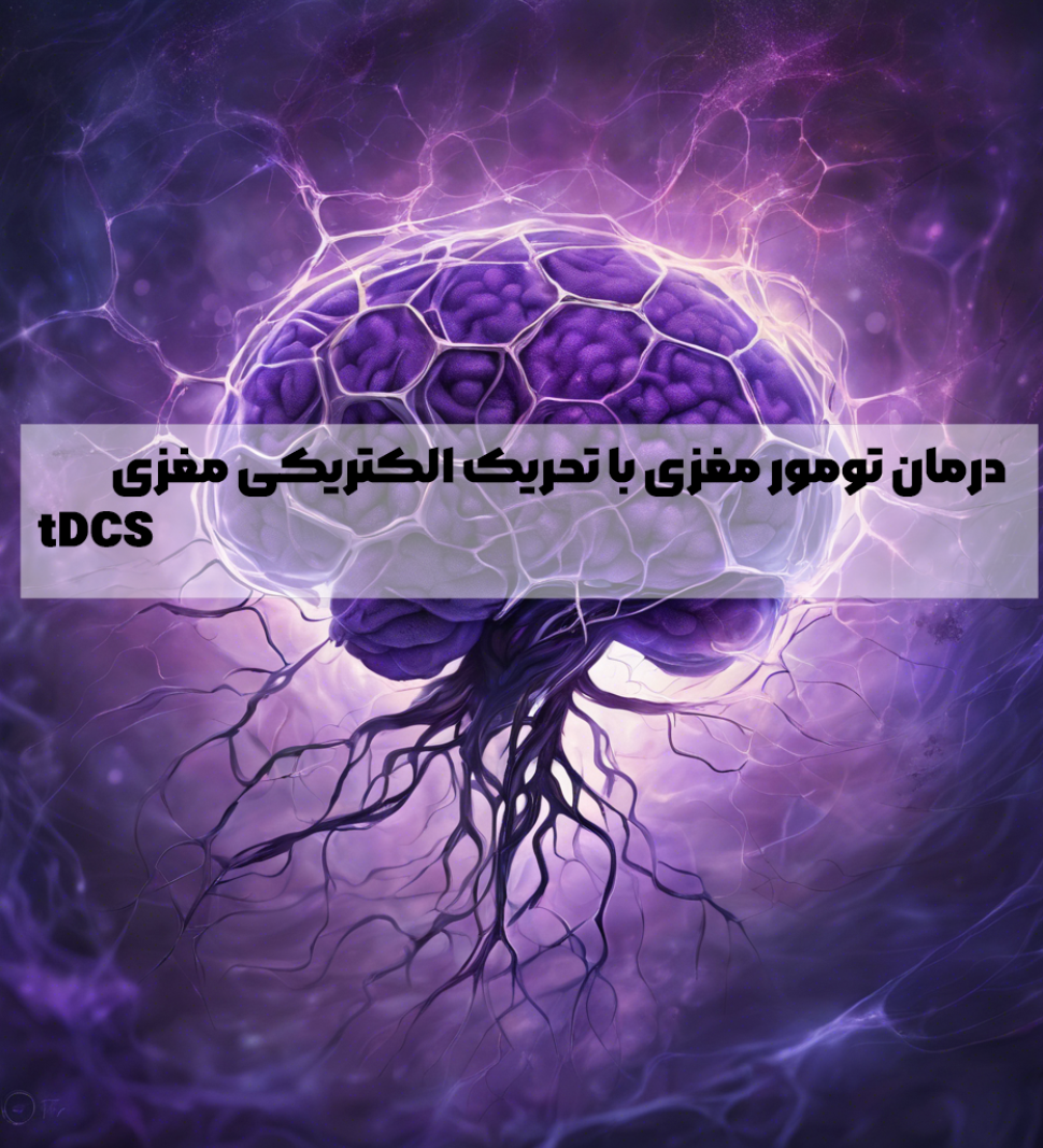 درمان تومور مغزی